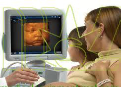 cheap ultrasound machine