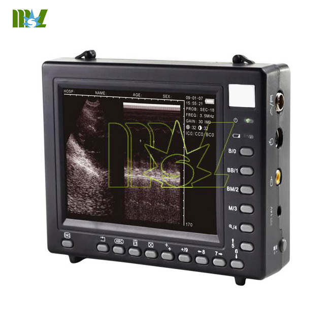 palmsize ultrasound scanner