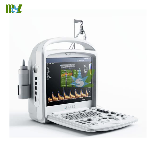 portable color doppler ultrasound