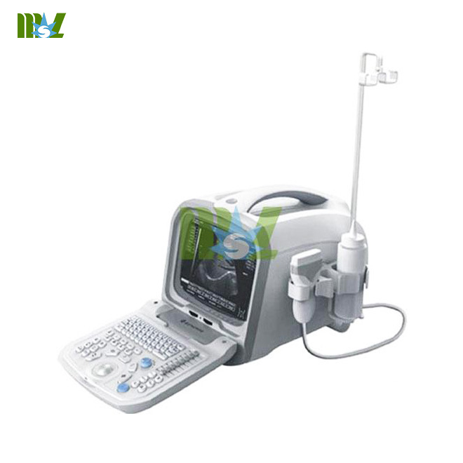 cheap portable ultrasound machine