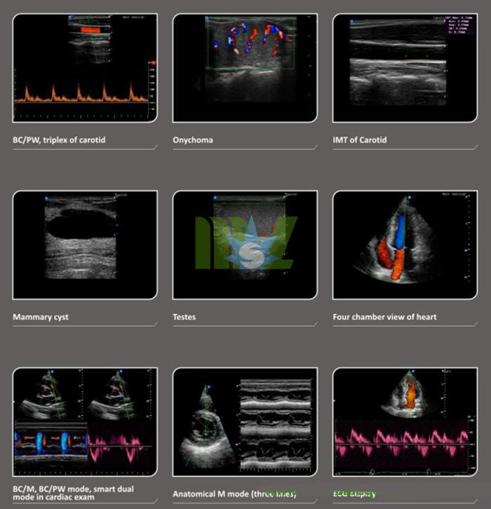 color doppler image