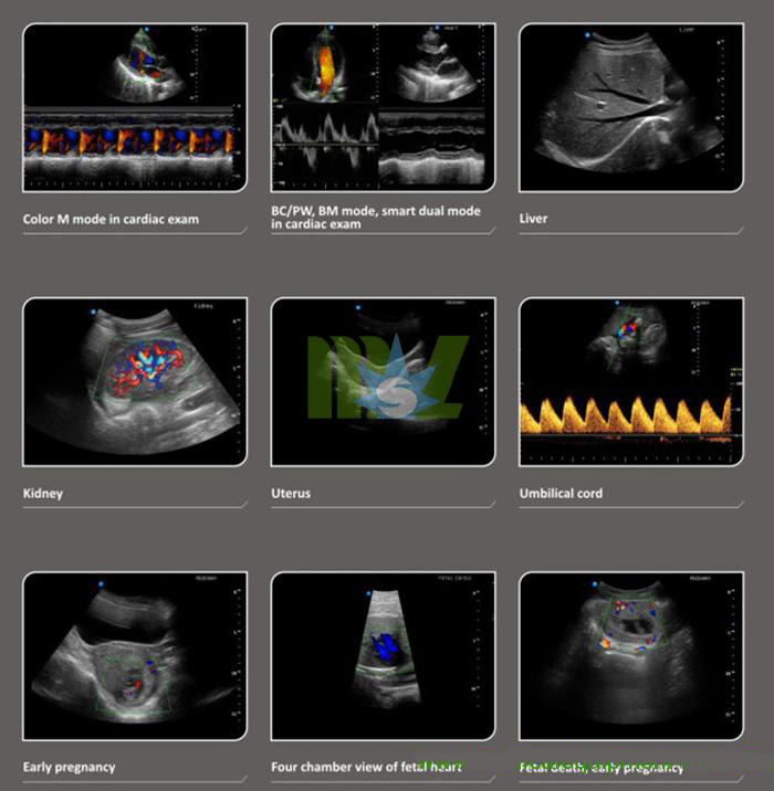 color doppler imagaing