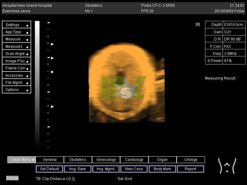 4D color doppler image