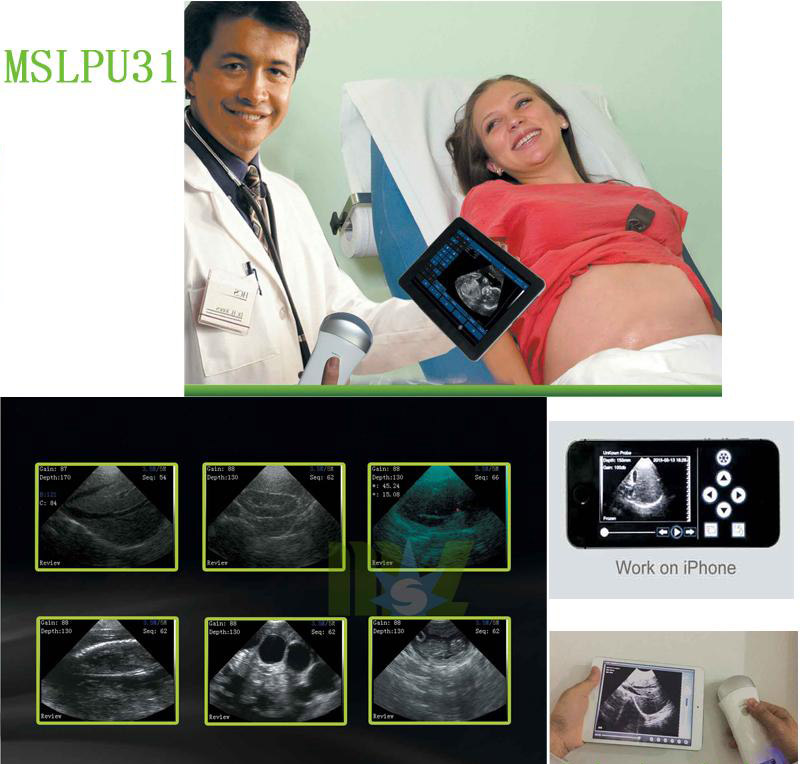 wireless ultrasound probe MSLPU31 for Sale