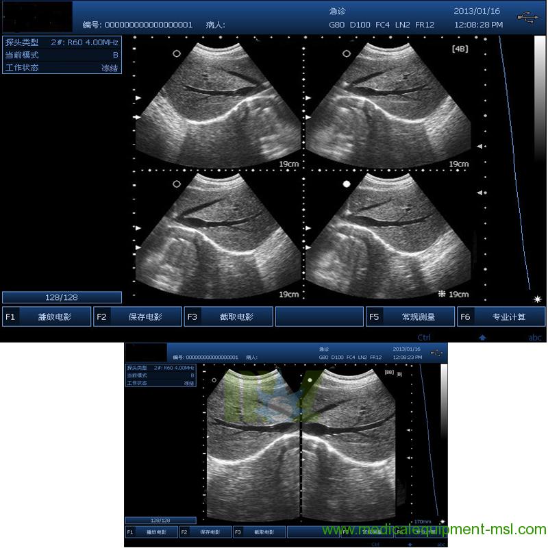  Advanced wireless ultrasound transducer MSLPU31 for Sale