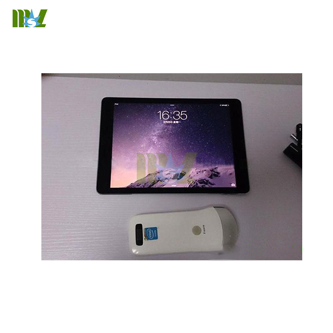 Advanced wireless ultrasound transducer wireless ultrasound probe