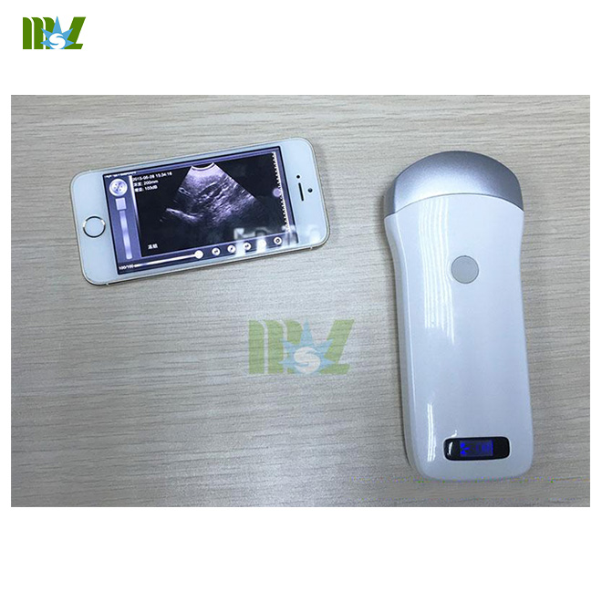Advanced wireless ultrasound transducer wireless ultrasound probe