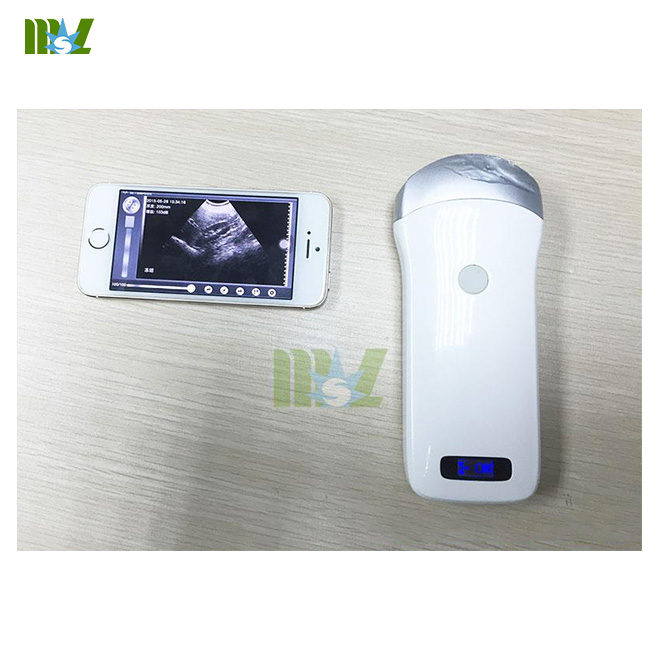 MSL wireless ultrasound probe MSLPU31 for Sale