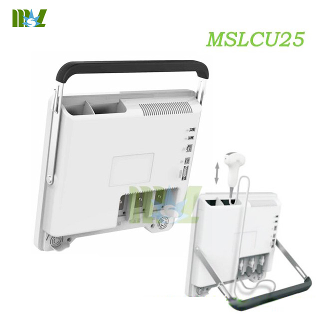 MSL Hot sale protable touch screen color doppler ultrasound MSLCU25