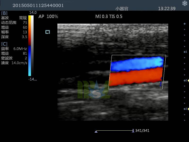 doppler ultrasound MSLCU25 for sale