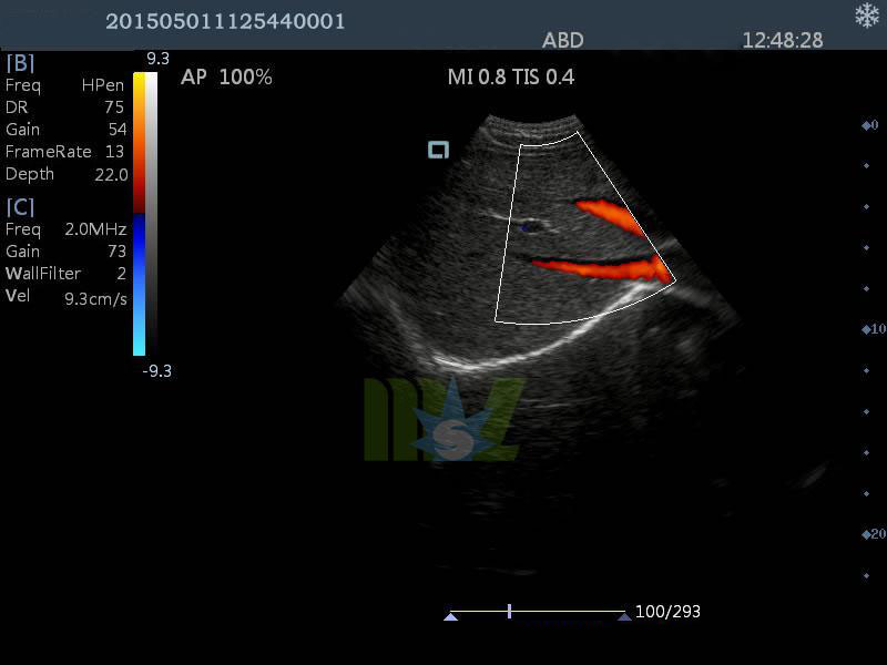 Excellent Diagnostic Imaging and Aesthetics Equipment MSLCU25