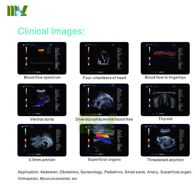 portable 3d/4d ultrasound diagnostic imaging system