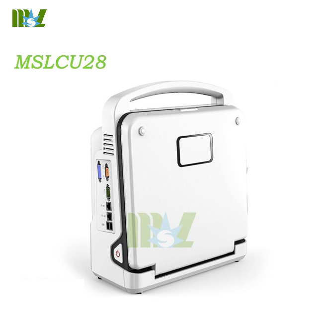 4d color doppler ultrasound diagnosis system