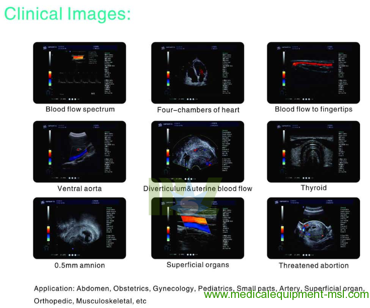 Portable 4d color doppler ultrasound diagnostic MSLCU28 Imaging Modes