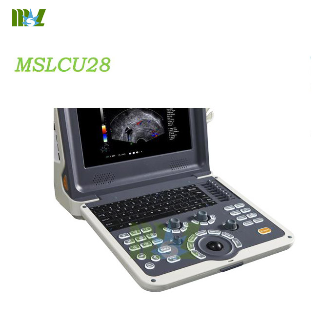 4d digital color doppler ultrasound diagnostic system MSLCU28