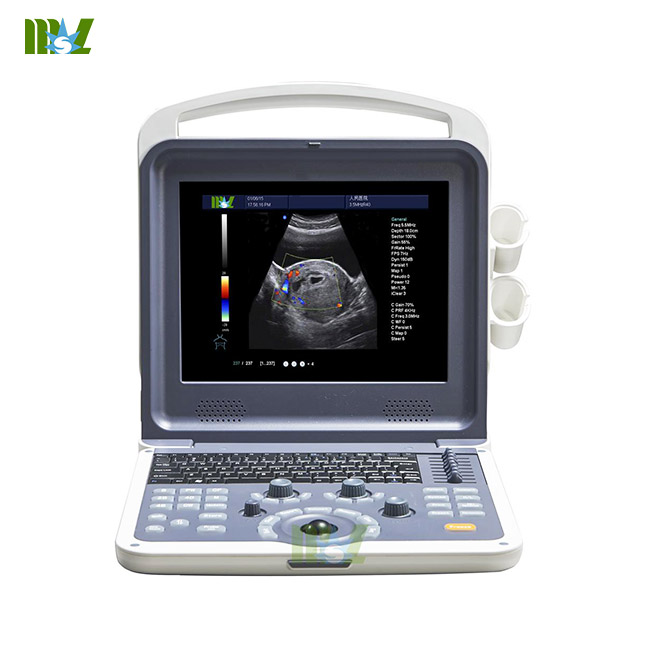 4d color doppler ultrasound diagnosis system MSLCU28 screen