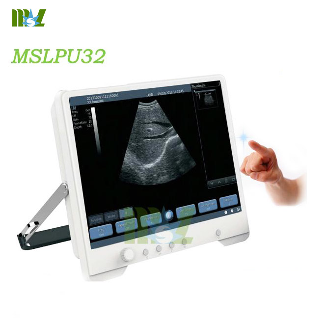 Touch-screen digital ultrasound MSLPU32for sale