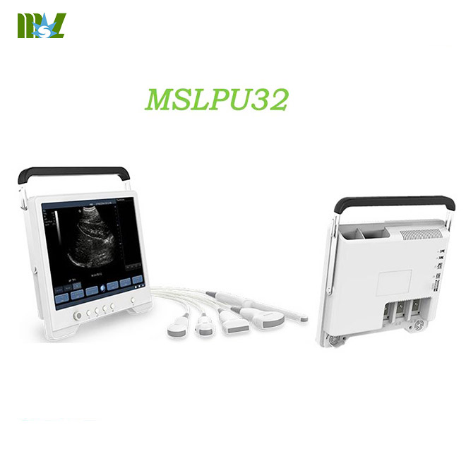 Excellent Diagnostic USG Imaging