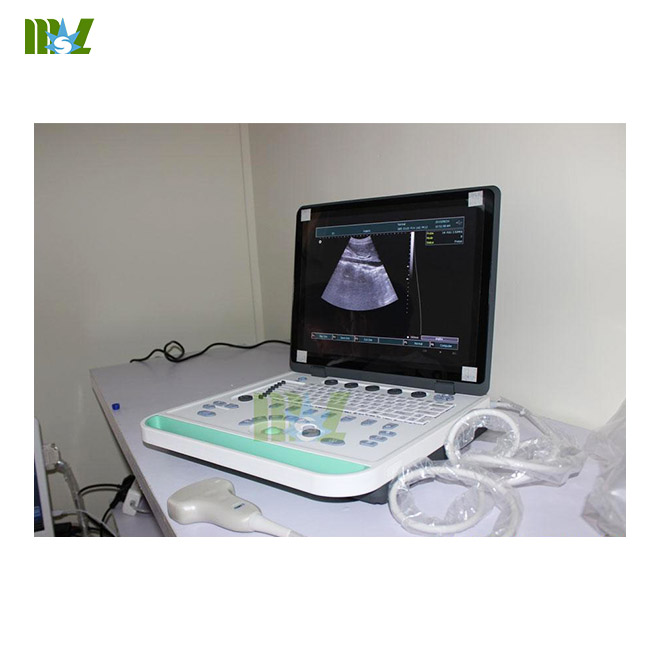 cheap 3d laptop ultrasound machine MSLPU34 for sale