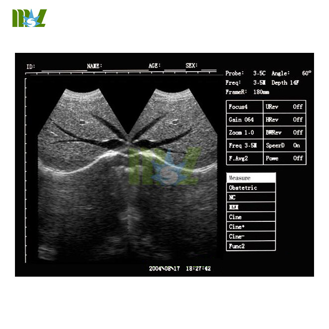 laptop ultrasound machine MSLPU34 for sale