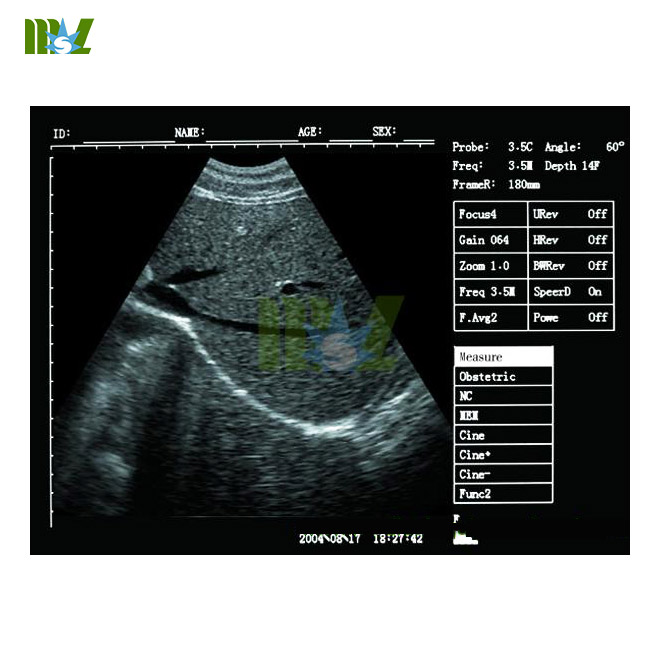 MSL cheap 3d laptop ultrasound machine MSLPU34