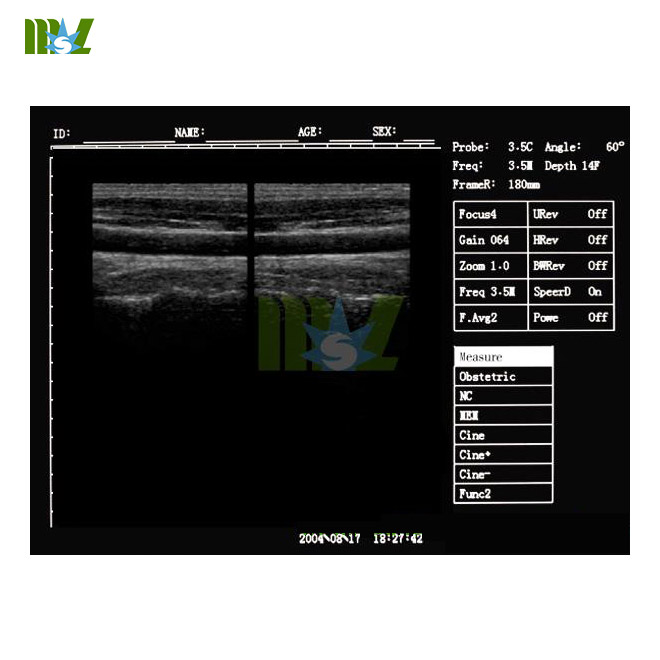 MSL 3d laptop ultrasound machine MSLPU34