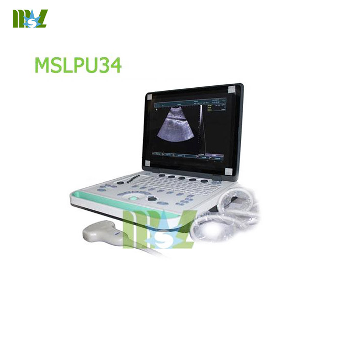 What is 3D ultrasound