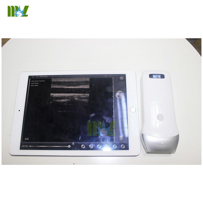 MSL ultrasound probe MSLPU31(working with iphoneipad)