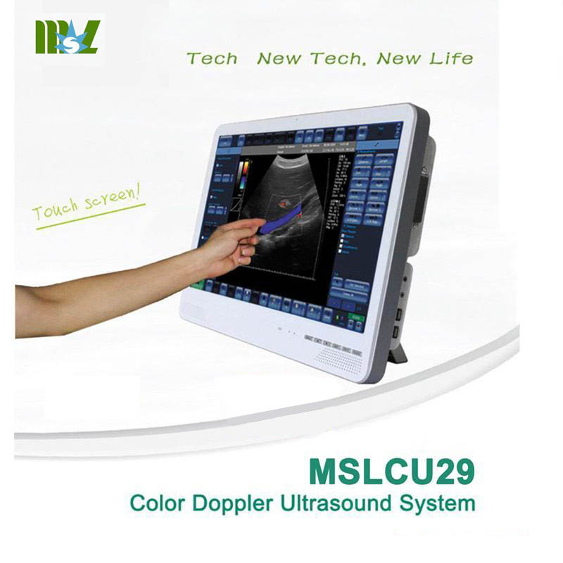 What is color ultrasound
