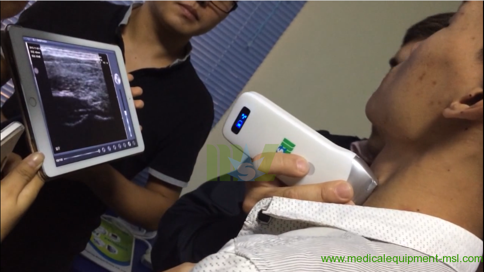 best Advanced wireless ultrasound Scan linear Probe MSLPU35