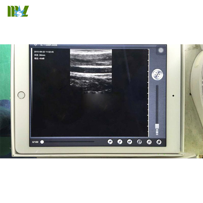 best wireless ultrasound Scan linear Probe MSLPU35