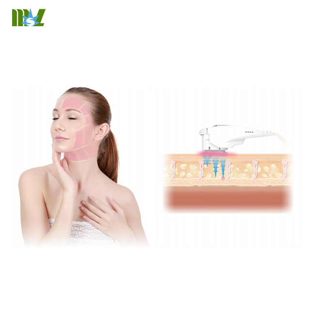 cheap High intensity focused ultrasound MSLHF01