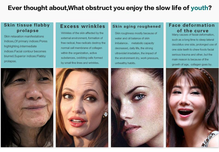 High intensity focused ultrasound MSLHF01 for sale