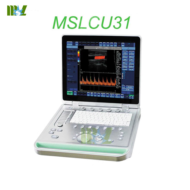 portable color doppler ultrasound MSLCU31 for sale