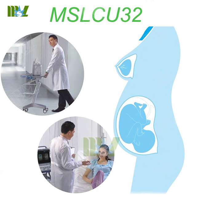 MSL Touch Digital Mobile Color Doppler ultrasound MSLCU32 for sale