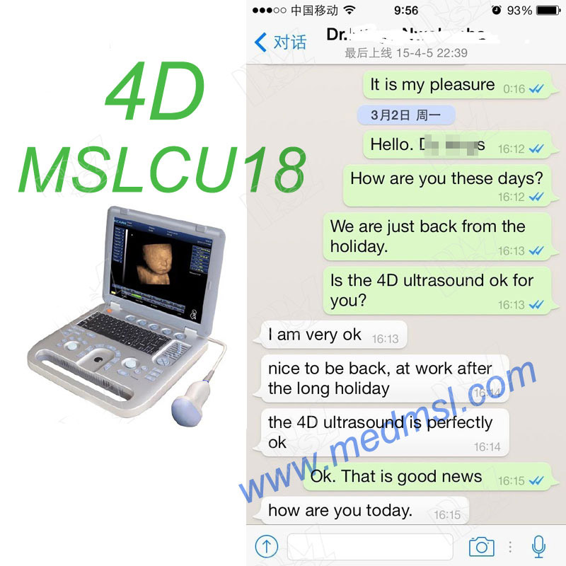 3D&4D ultrasound machine in China-MSLCU18 Praises From Clients