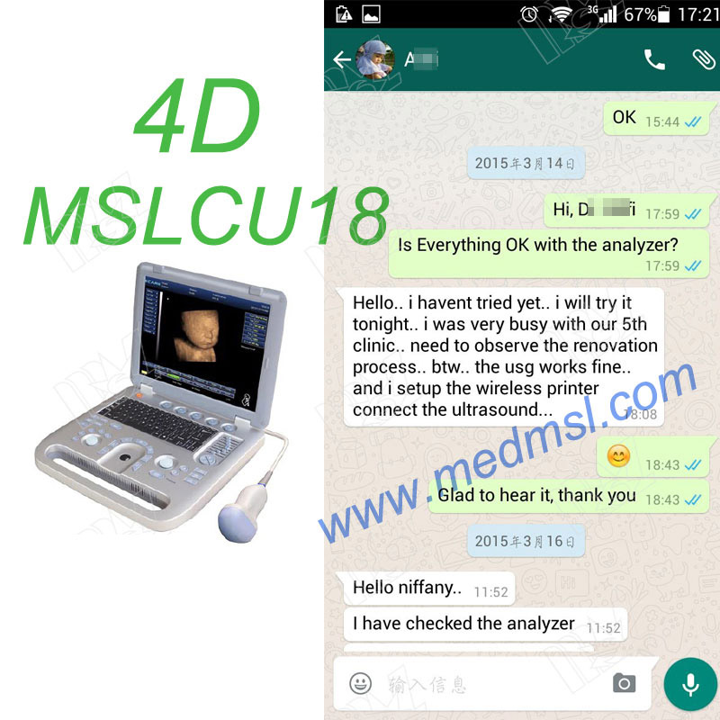 portable 3D&4D ultrasound machine in China-MSLCU18 Praises From Clients