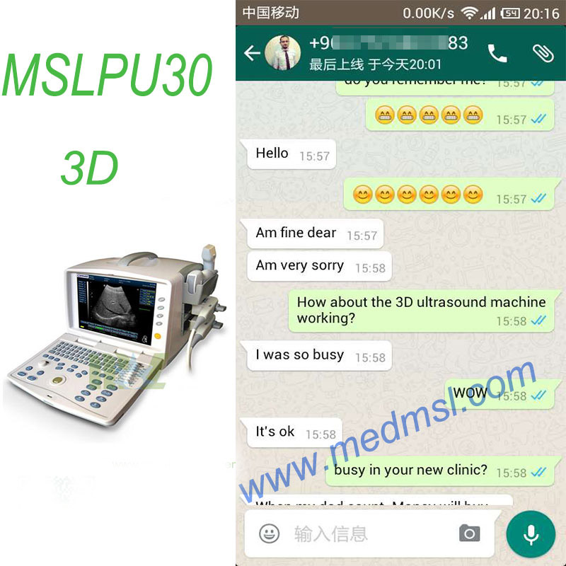 digital laptop ultrasound MSLPU30 Praises From Clients