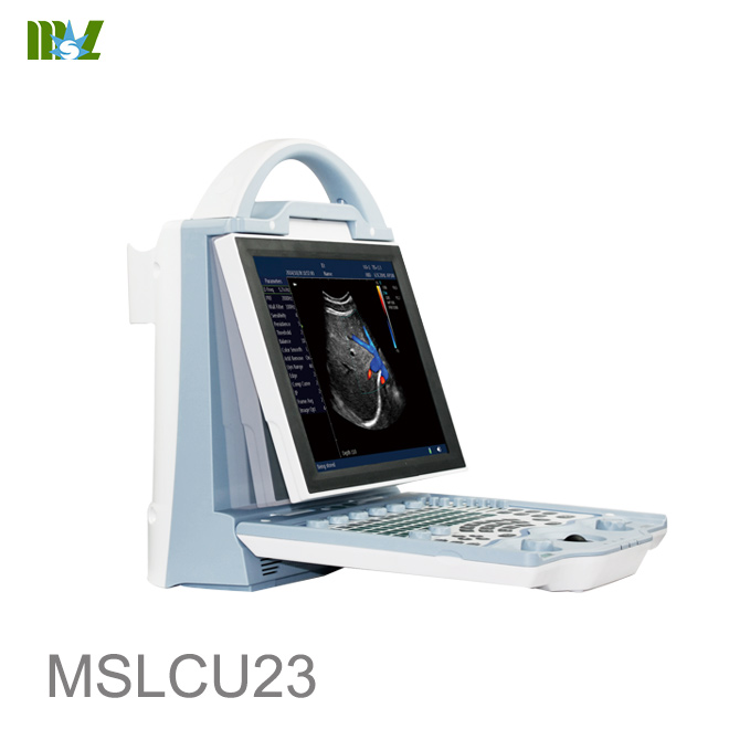 Advanced wireless ultrasound transducer wireless ultrasound probe