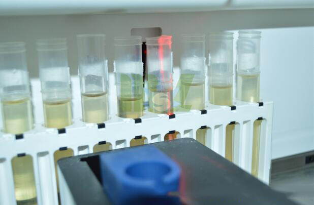 New Urine Analyzer MSLUA11