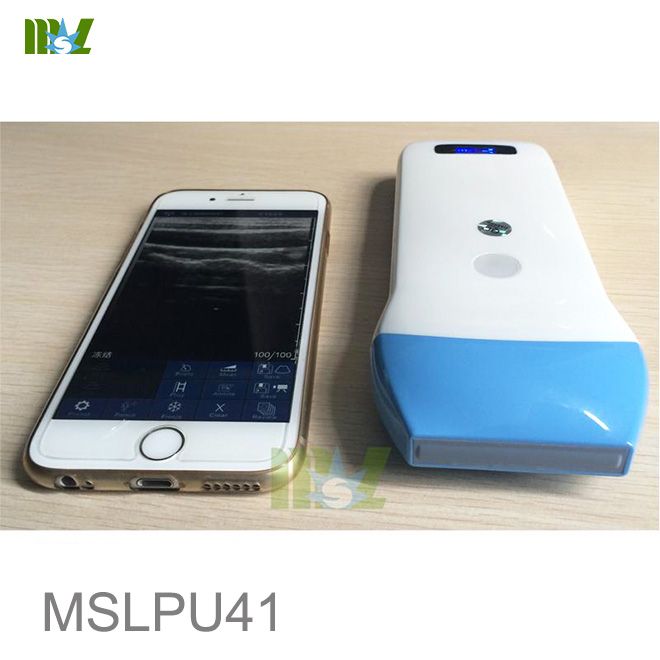 Wireless USG 128 Element Ultrasound Scan linear Probe MSLPU41