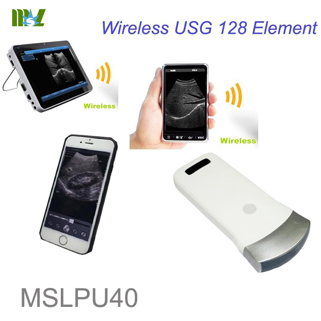 2016 Advanced wireless ultrasound Scan linear Probe MSLPU35