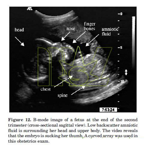 B-mode Ultrasound Imaging