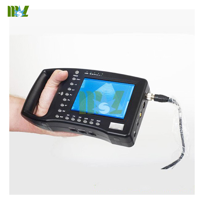 handheld ultrasound scanner