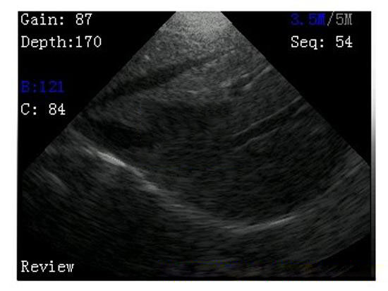 ultrasound image