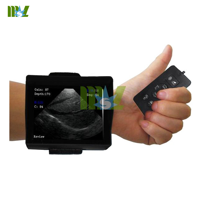 wrist ultrasound