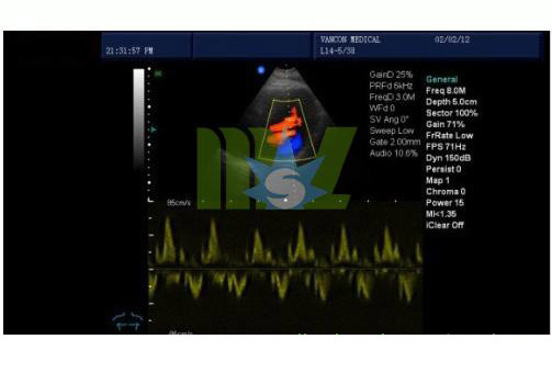 color doppler for cardiac