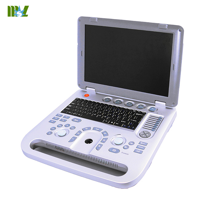 laptop ultrasound system