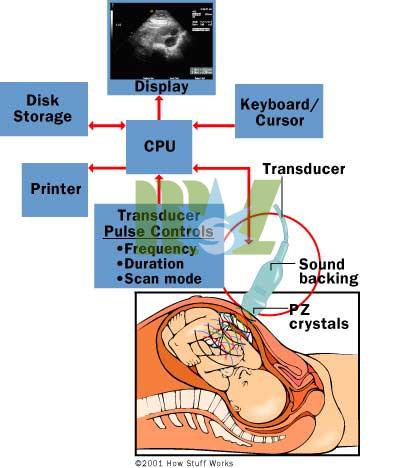 handheld ultrasound
