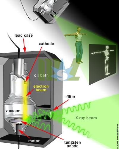 Portable fluoroscopy x-ray machine